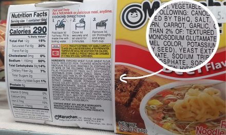 Obesidat, adipositas i sobrepeso